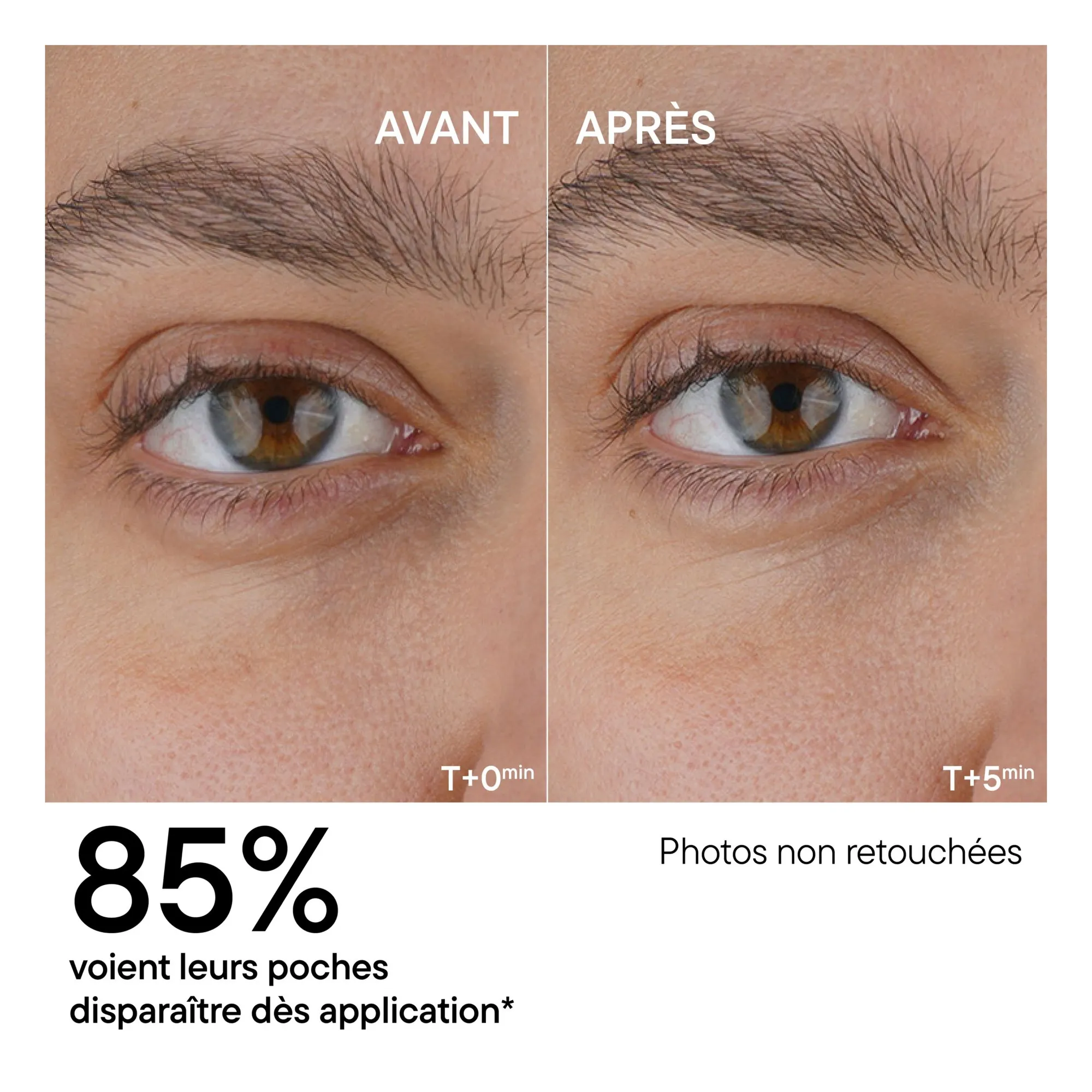 Serum Contorno de Ojos Anti-Fatiga - 15 ml- Imagen del producto n°2