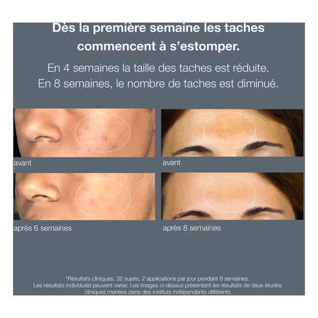 Siero anti-macchie powerbright - 30ml 
