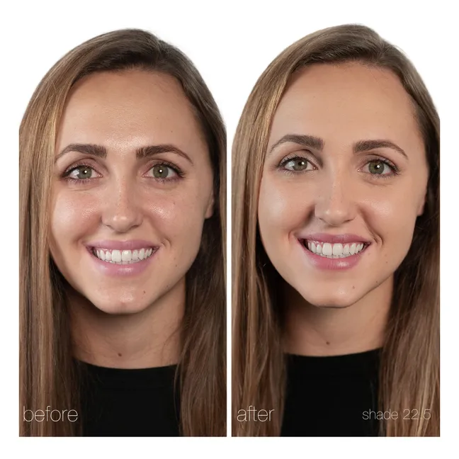 Correcteur UnCoverup - 5,67g | 22,5