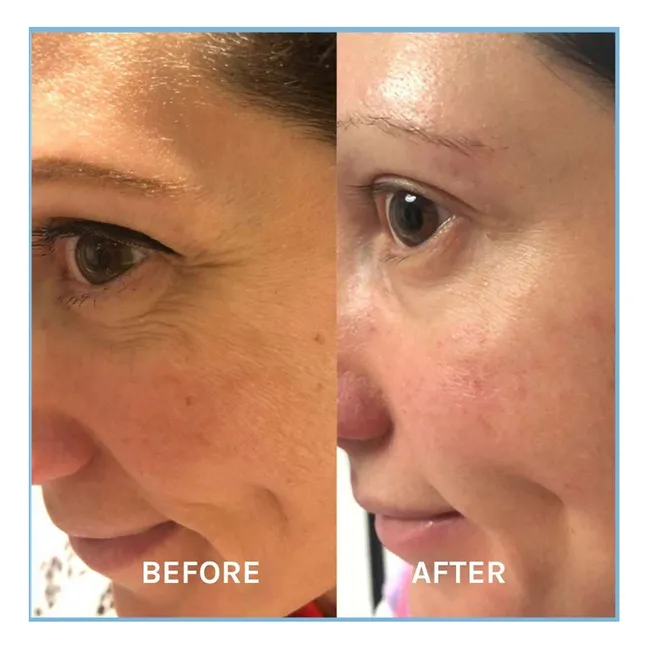 Defying Lifting Anti-Aging Serum - 30 ml