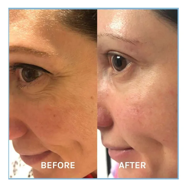Siero anti-età Defying Lifting - 30 ml