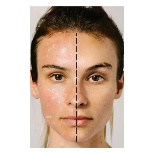 Exfoliante Bioactivo Rosa